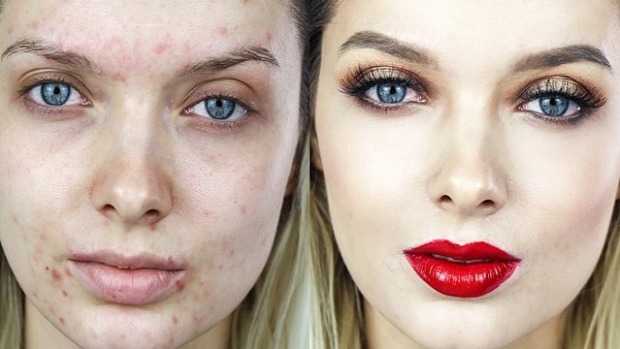 Em Ford courageously revealed her pre-makeup skin to her social media followers. (Source: Instagram.com)