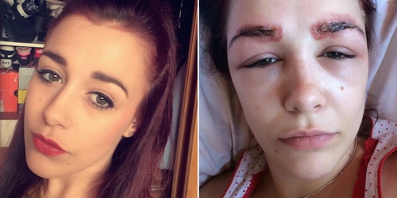 Smith before and after her HD brows horror story. (Source: elitedaily.com)