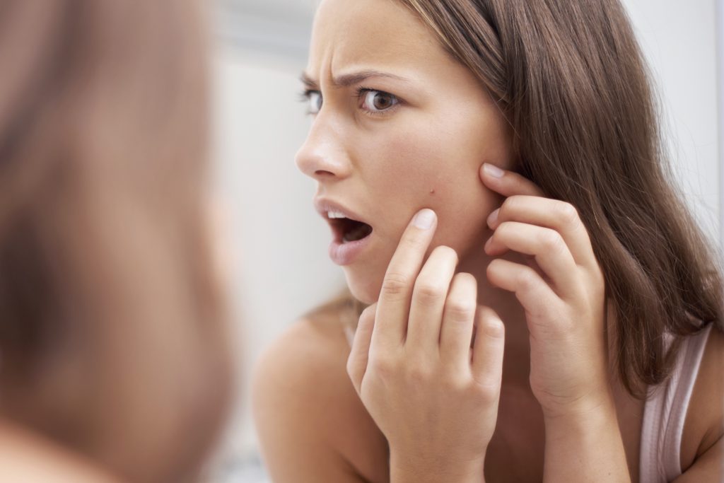 Acne is tough to deal with, but it's even harder to deal with the after effects of scarring. 