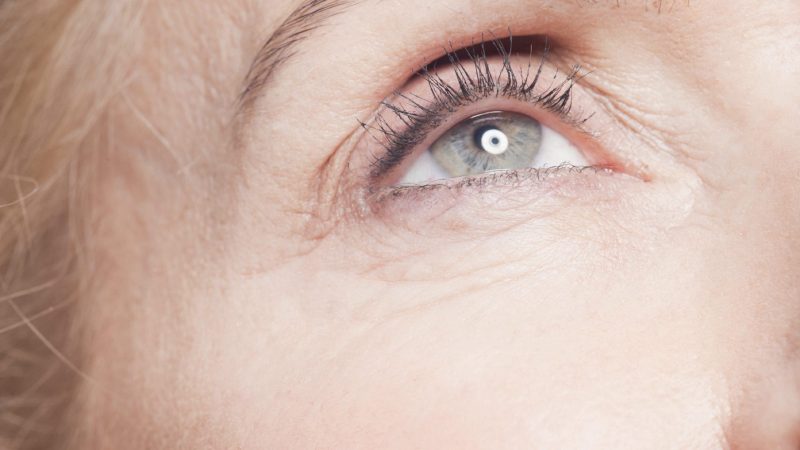Tech update: Is this the end of wrinkles?