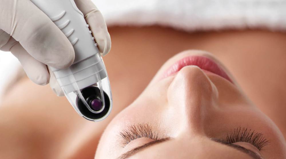 Achieve outstanding results with DermaFrac