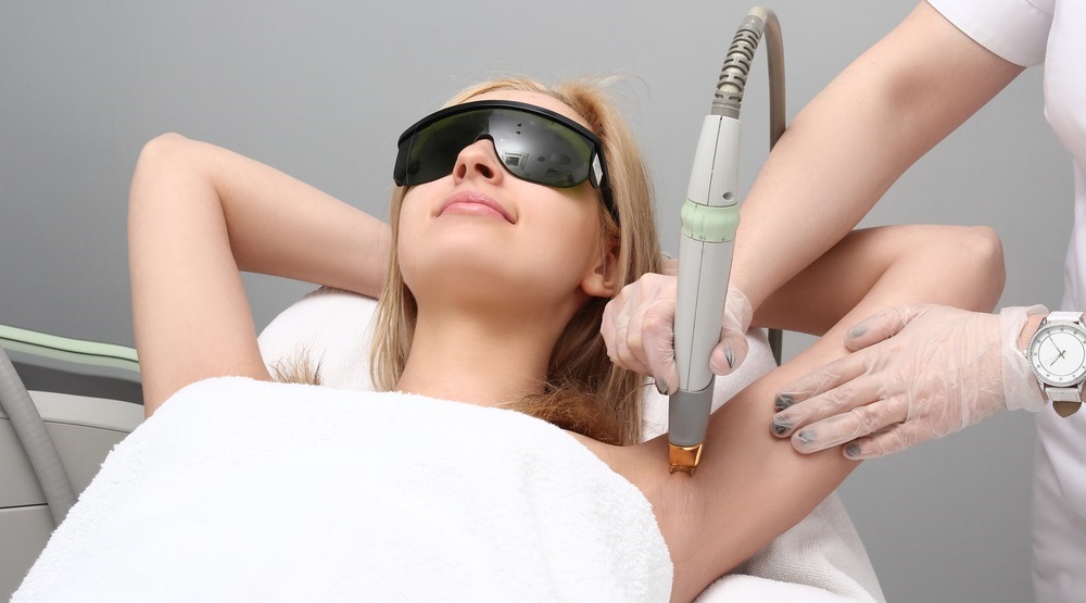 How to prepare for laser hair removal