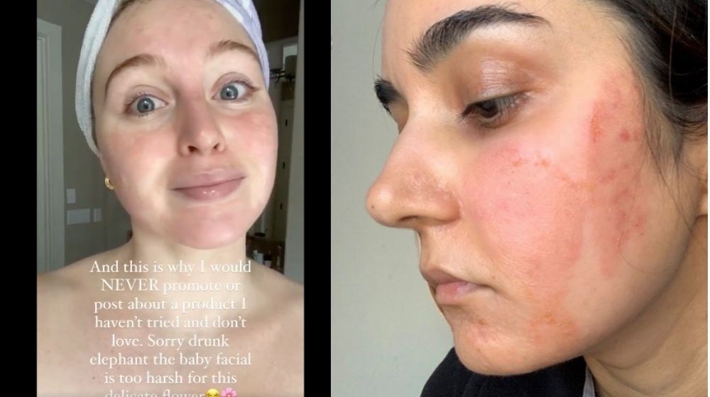 Exfoliation backlash is being driven by high-profile influencers and journalists online.