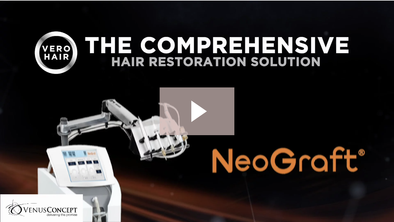 NeoGraft: The Comprehensive Hair Restoration Solution