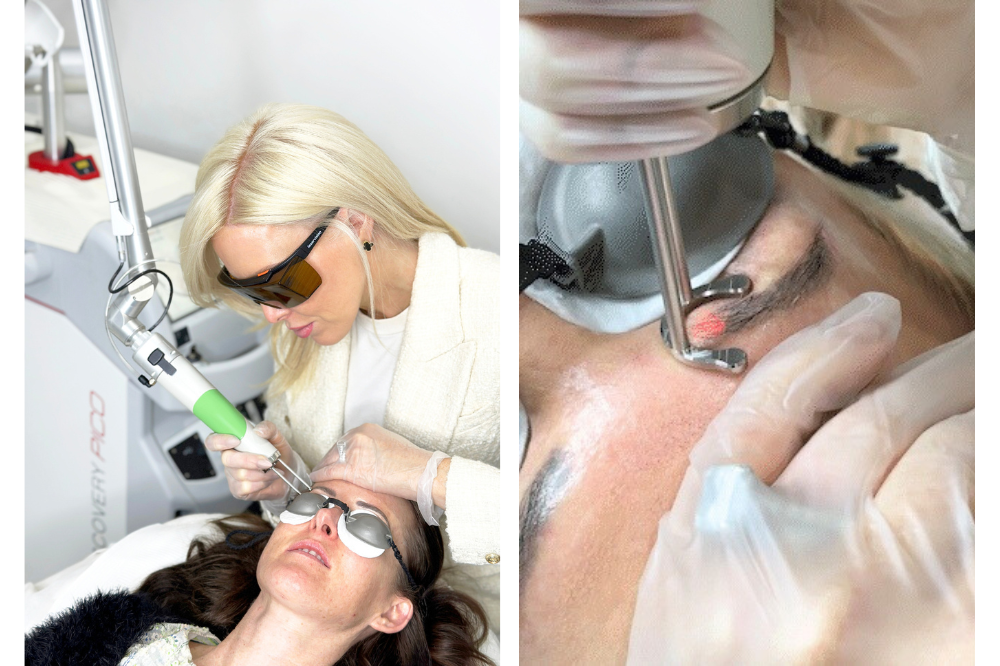 Amy Jean to Take Laser Tattoo Removal to New, Luxurious Ground