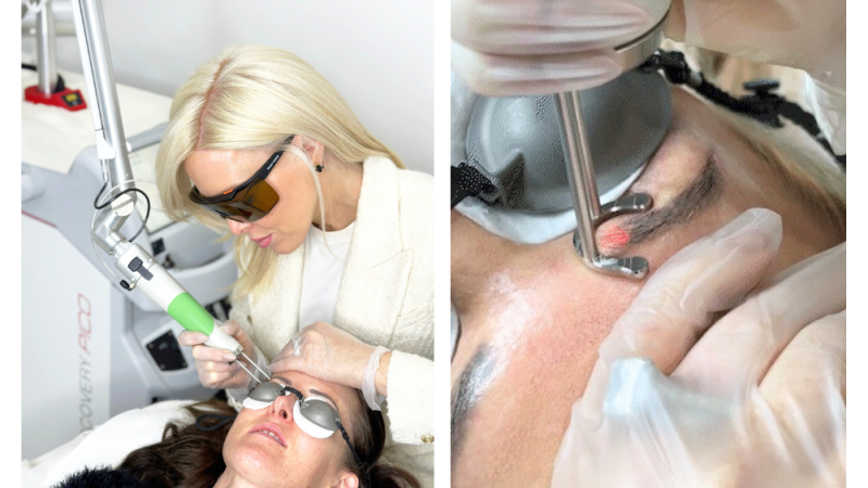 Amy Jean to Take Laser Tattoo Removal to New, Luxurious Ground