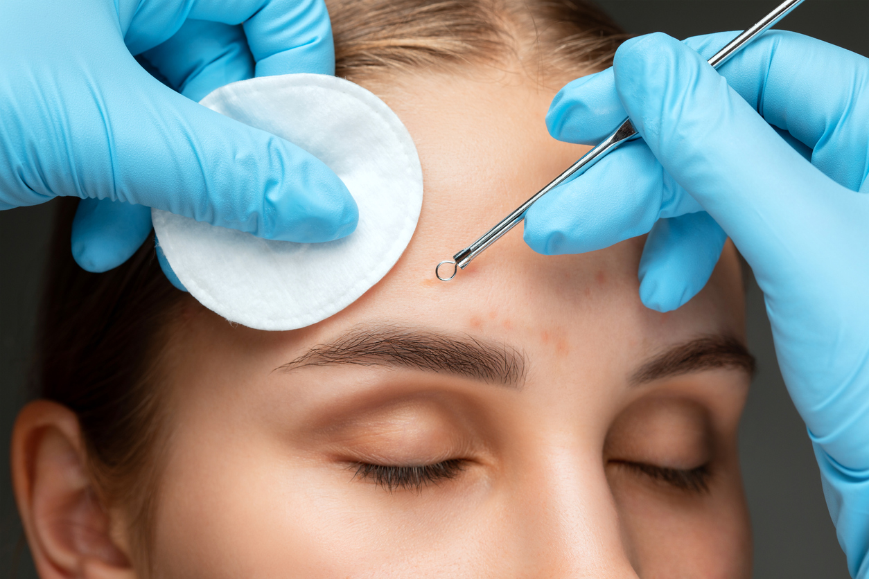 “Practice Makes Perfect” When It Comes to Performing Manual Extractions In-Salon